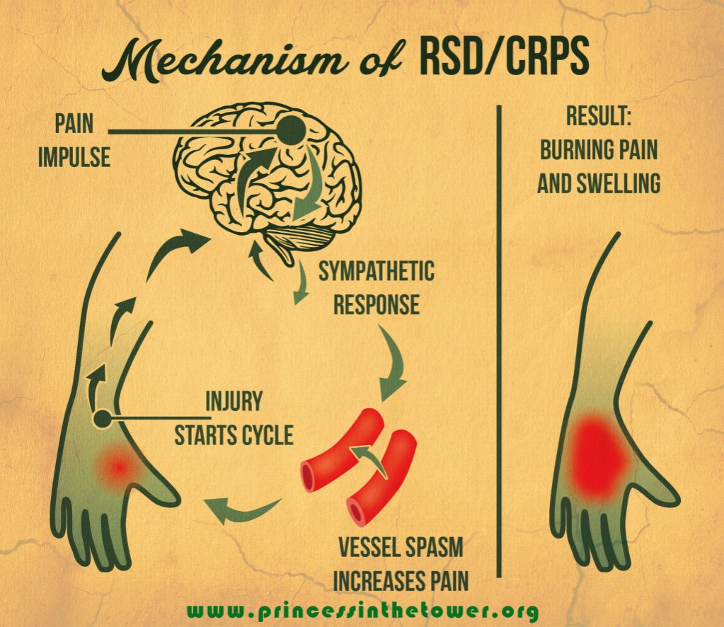 2 CRPS vintage 2